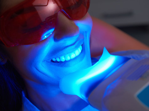 Teeth Whitening