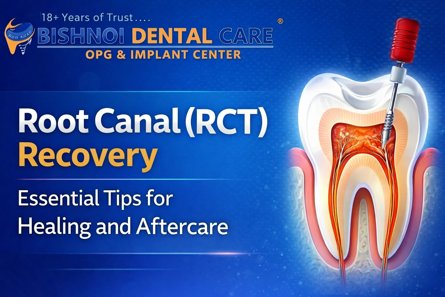 Root Canal Recovery Tips for Fast Healing After RCT
